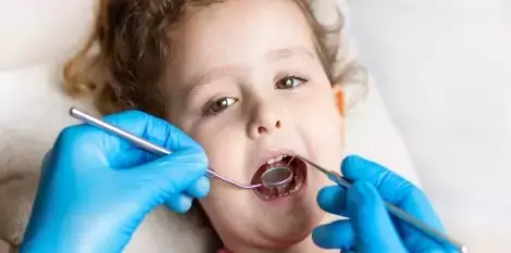 علاج اسنان الاطفال