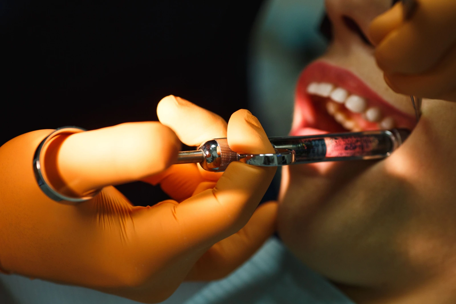 هل إبرة بنج الاسنان مؤلمة؟