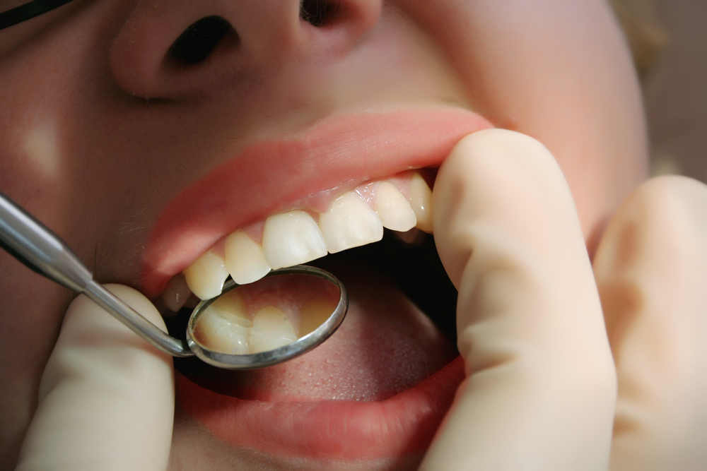 ما هي أسباب جفاف الفم وكيف يمكن علاجه؟