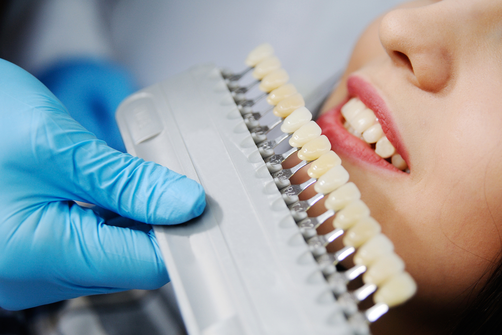 اهمية تركيب اسنان الزيركون لصحة الاسنان