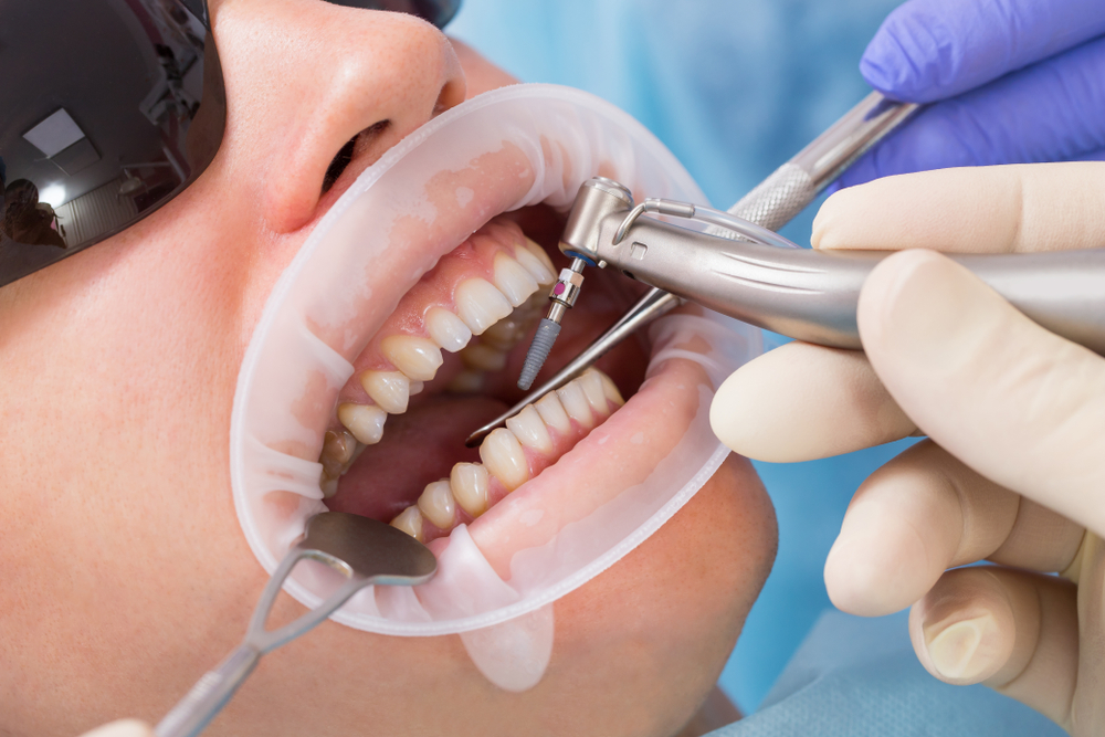 ما هو أفضل مركز في جدة لعلاج أمراض الفم والأسنان؟