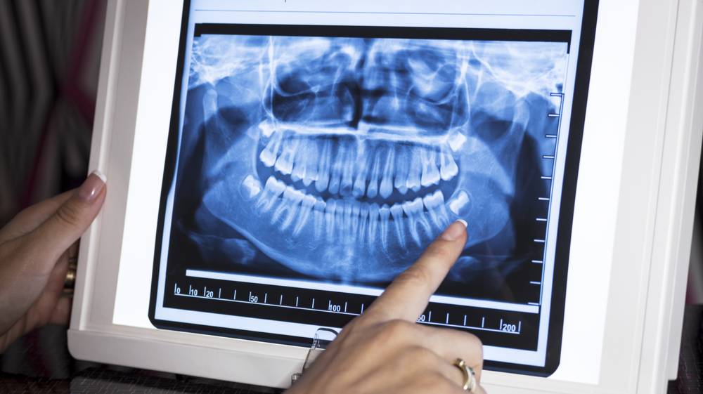 انواع أشعة الأسنان
