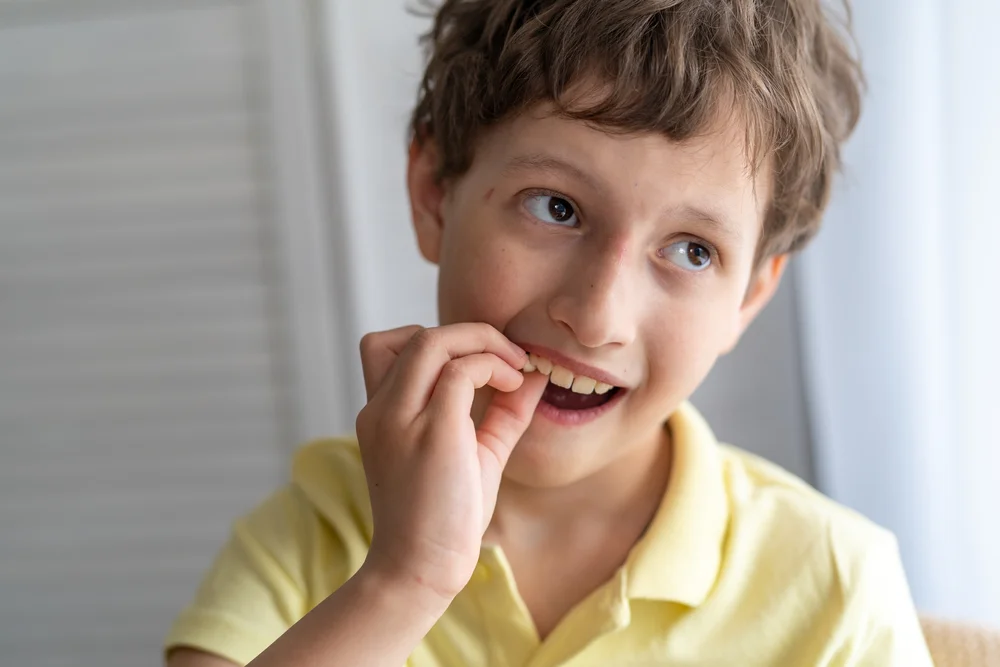 اسباب اصفرار الاسنان عند الاطفال