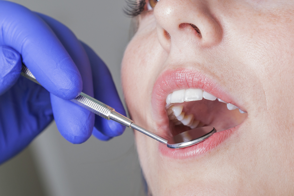 ما هو أفضل مركز لتجميل الأسنان في جدة؟