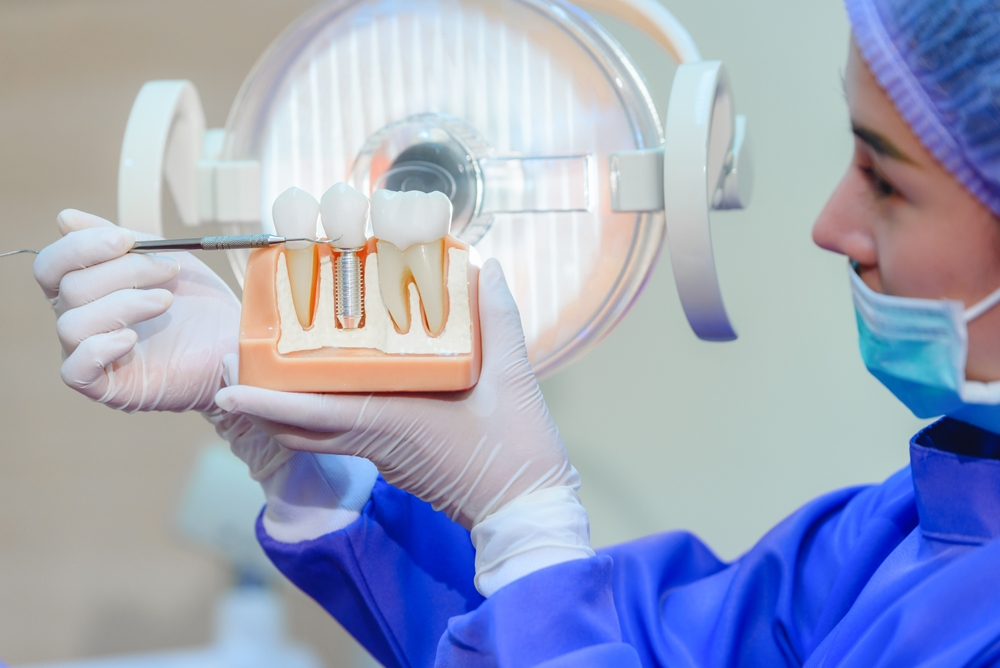 مميزات وفوائد زراعة الأسنان في جدة
