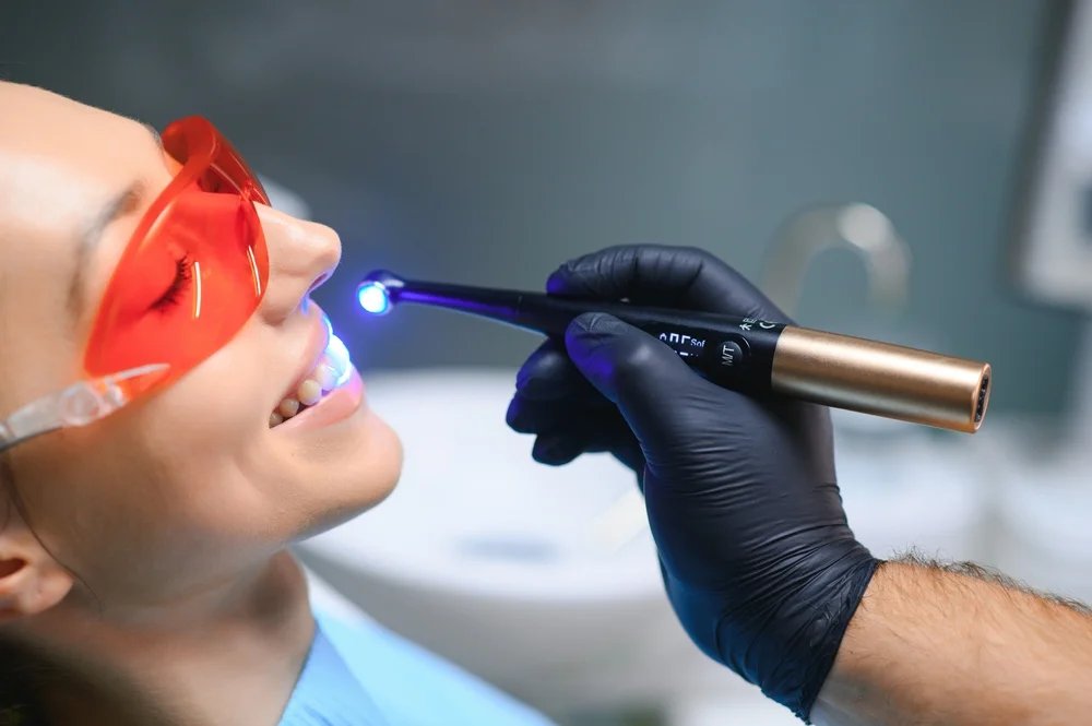 ما الفرق بين تلميع الأسنان وتبييضها