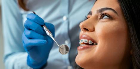 أفضل تقويم أسنان وما الطرق العلاجية في نجاح التقويم؟