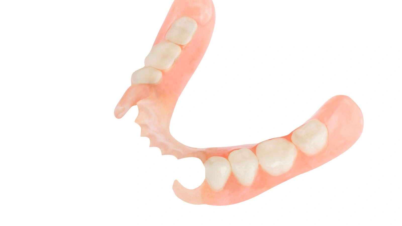 ما هو طقم الأسنان الجزئي؟ وما مميزاته وعيوبه؟
