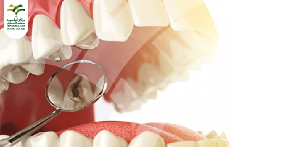 التهاب عصب الأسنان والأذن