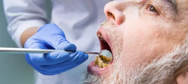 ما هي أسباب تصبغ الاسنان؟ طرق الوقاية منه؟ وكيفية علاجه؟