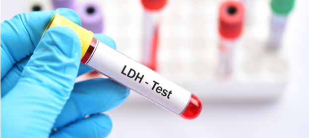 ما هو تحليل LDH؟ وعلام يشير ارتفاعه؟