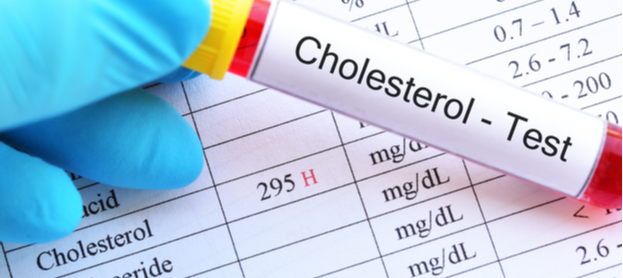 طرق علاج ارتفاع الكوليسترول والدهون الثلاثية