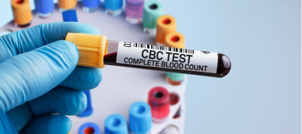 ما هي أهمية تحليل صورة دم كاملة؟