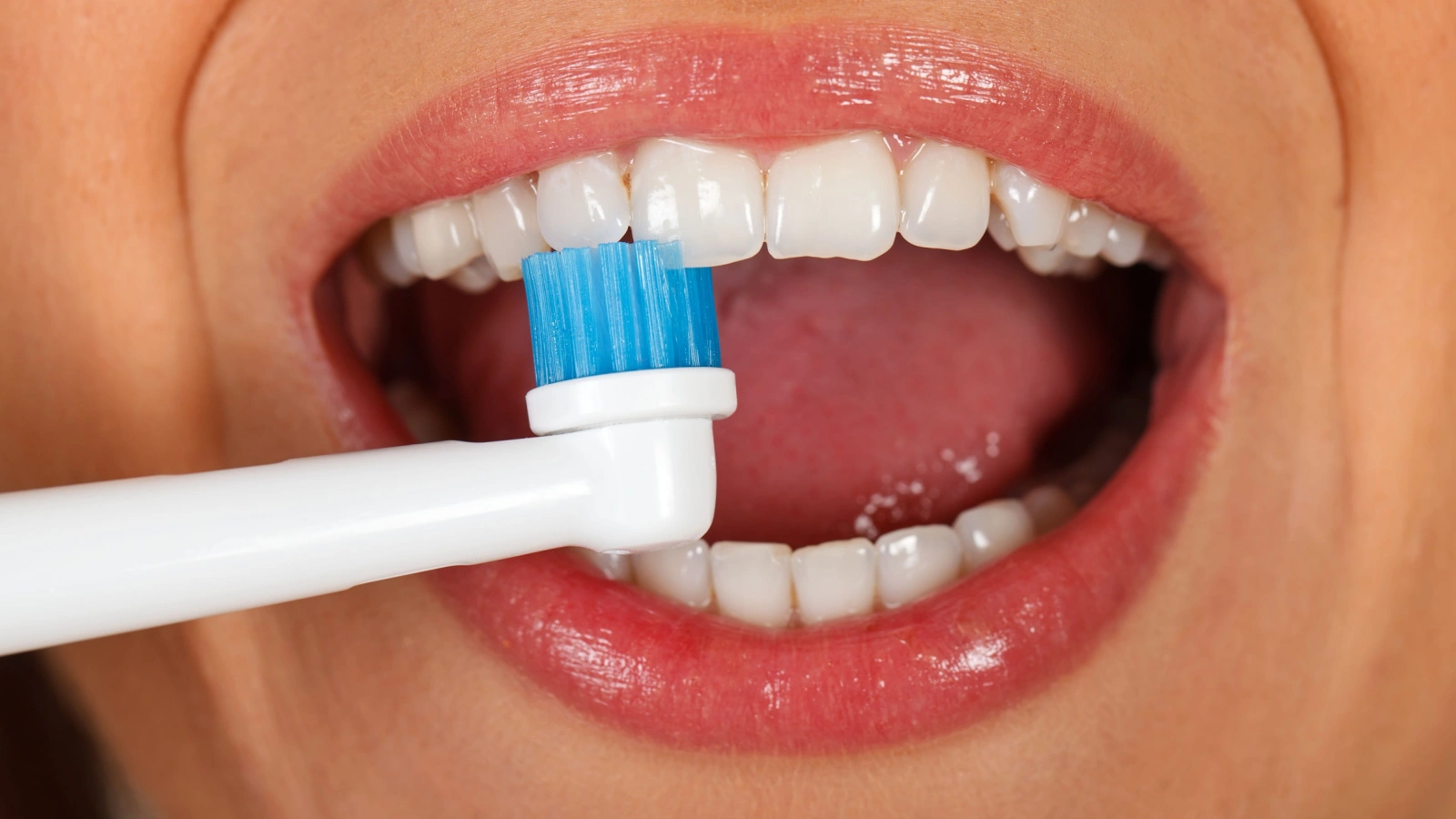 أفضل 8 نصائح للعناية بالأسنان بعد التنظيف من الجير