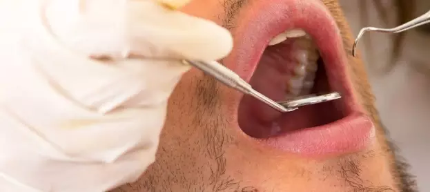 ما هي أنواع تسوس الأسنان؟ وكيفية الوقاية منها؟