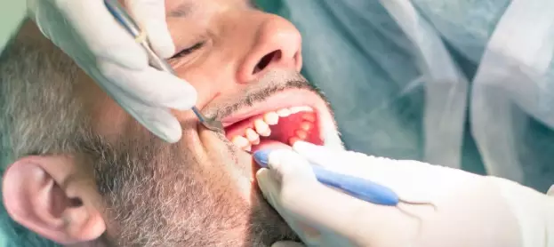 كيف يتم علاج جذور الأسنان؟ وما أحدث تقنياته؟