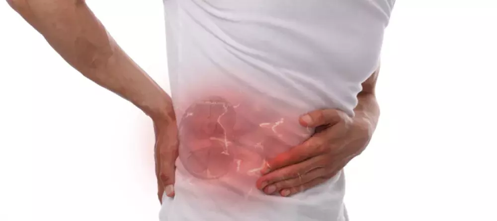 أعراض الفشل الكلوي: تعرف على العلامات المبكرة وطرق تشخيصه والوقايه