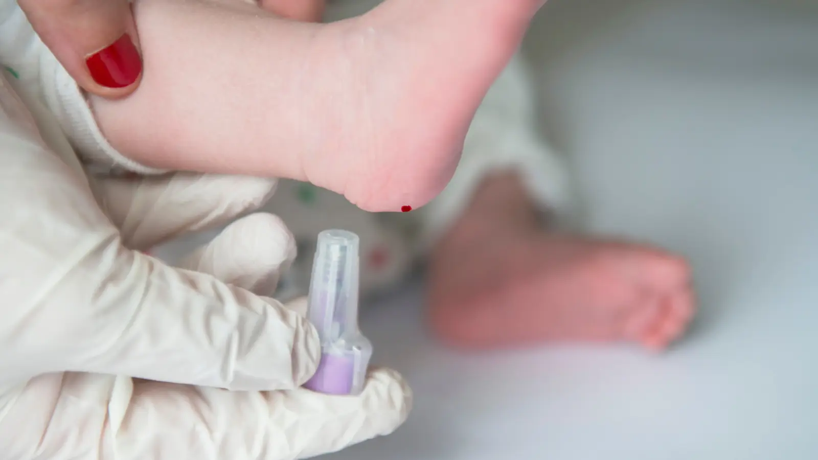 تحليل الدم للأطفال حديثي الولادة