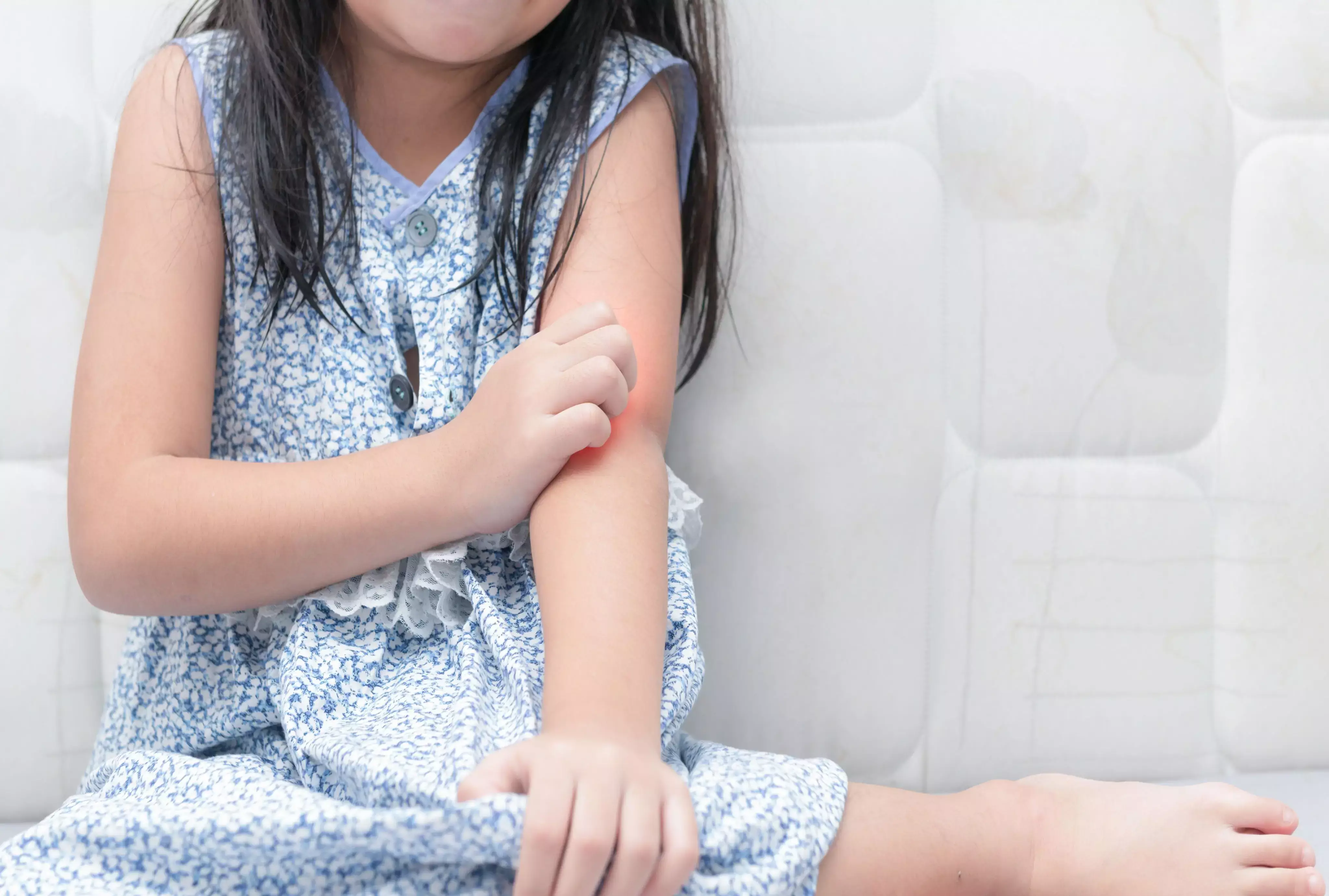 أسباب حساسية الجلد عند الأطفال