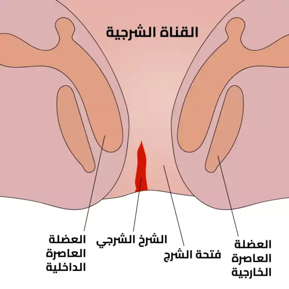 شكل الشرخ بالصور عند الأطفال