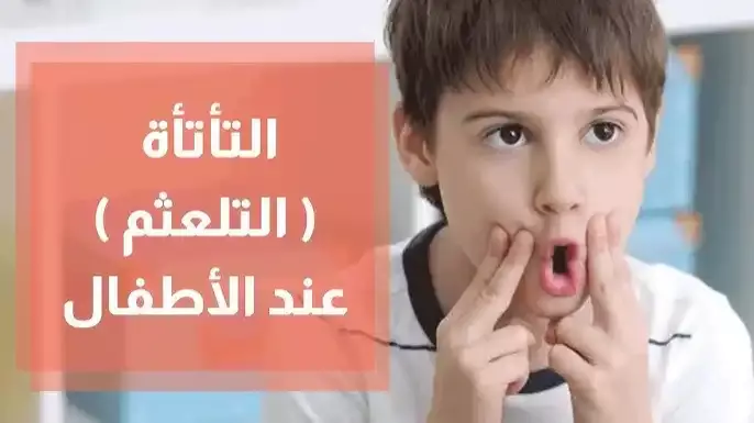 التأتأه عند الاطفال وعلاجها