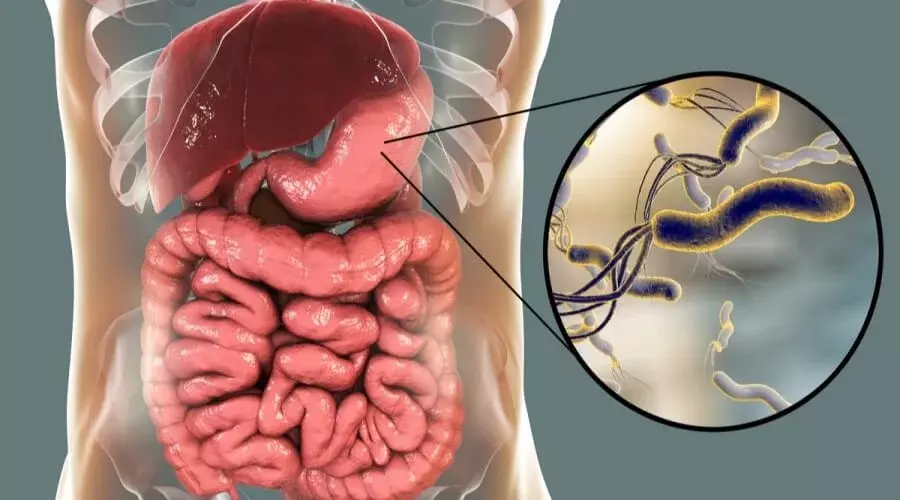مدة علاج جرثومة المعدة للاطفال
