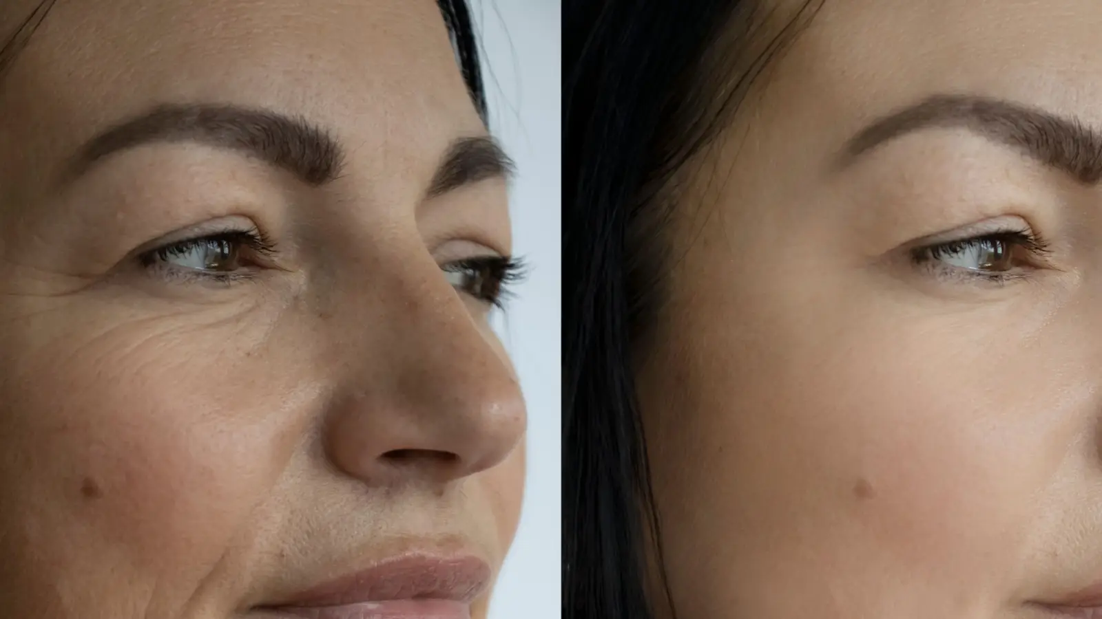 ما هي أحدث التقنيات لعلاج تجاعيد الوجه؟
