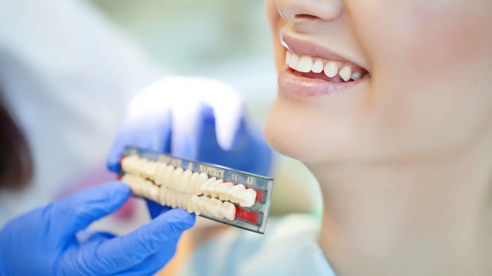 ما هي جسور الأسنان؟ وما هي عيوبها ومميزاتها وطرق العناية بها؟