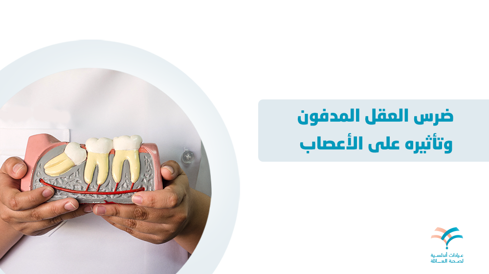 ضرس العقل المدفون وتأثيره على الأعصاب
