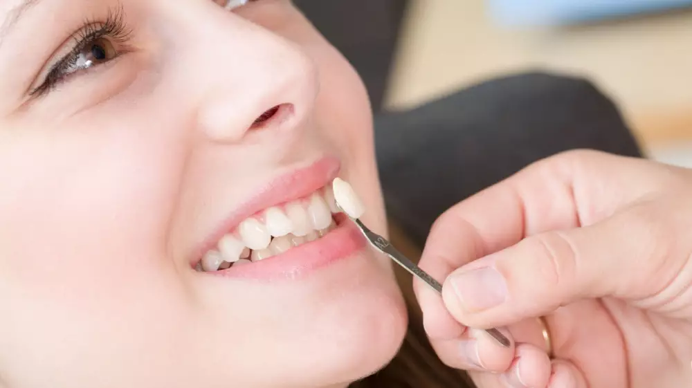 ما هي استخدامات العدسة اللاصقة للأسنان؟