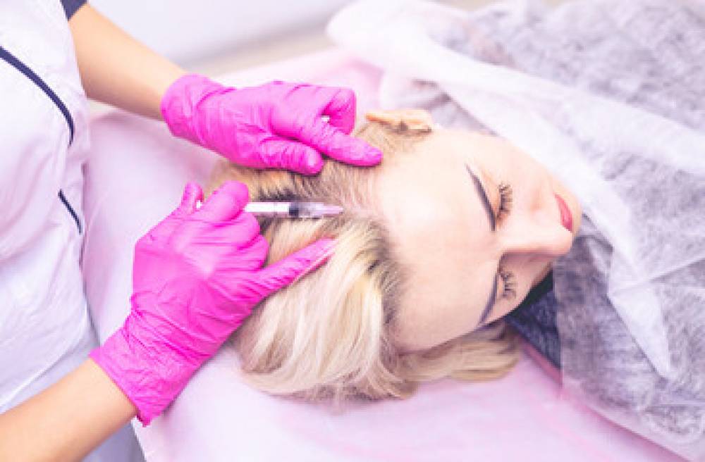 علاج الميزوثيرابي للشعر