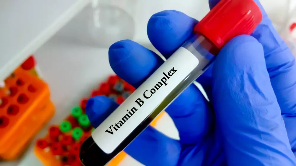 كيف يتم تحليل فيتامين ب ومتى تحتاجه؟