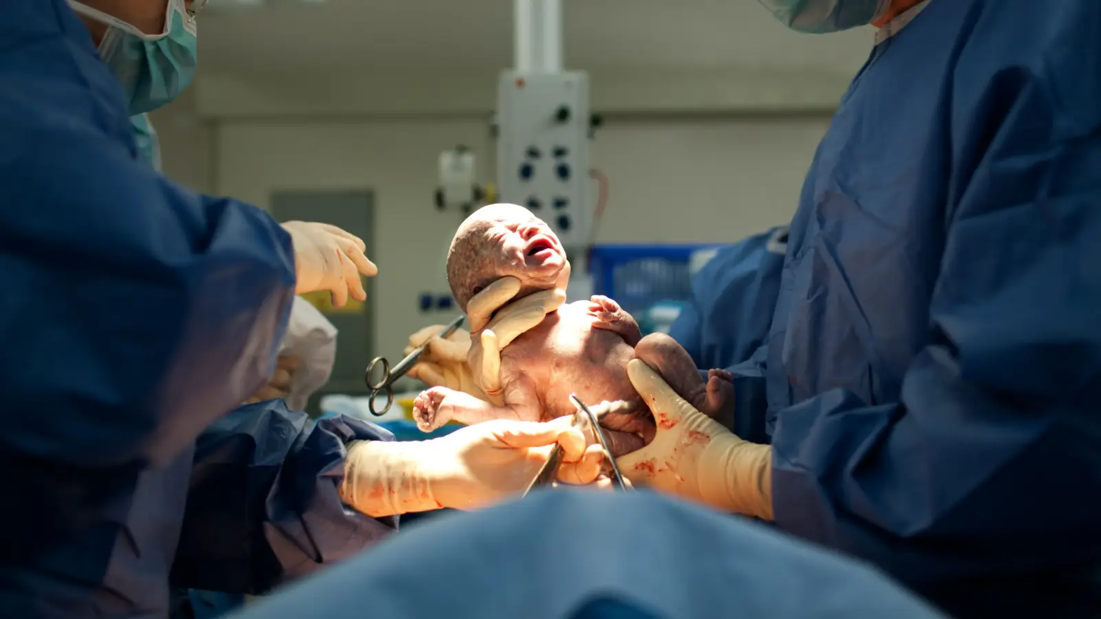 ما هي أسباب الولادة القيصرية؟ وما هي مضاعفاتها المحتملة؟