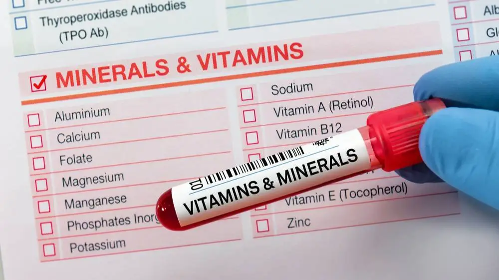 ما هي أنواع تحليل الفيتامينات والمعادن؟