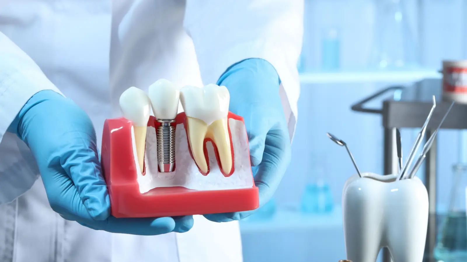 ما هي افضل عيادة زراعة اسنان في جدة؟