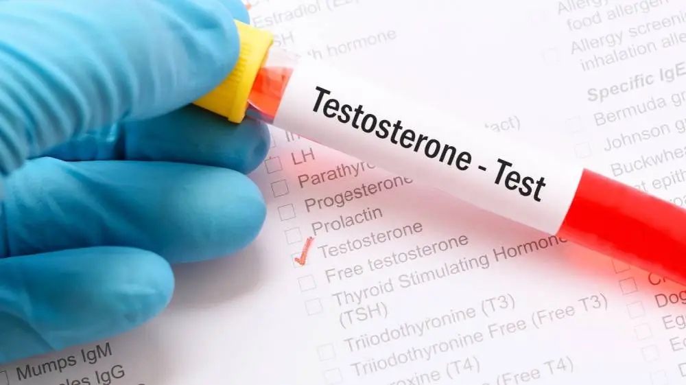 لماذا يطلب الطبيب تحليل التستوستيرون؟