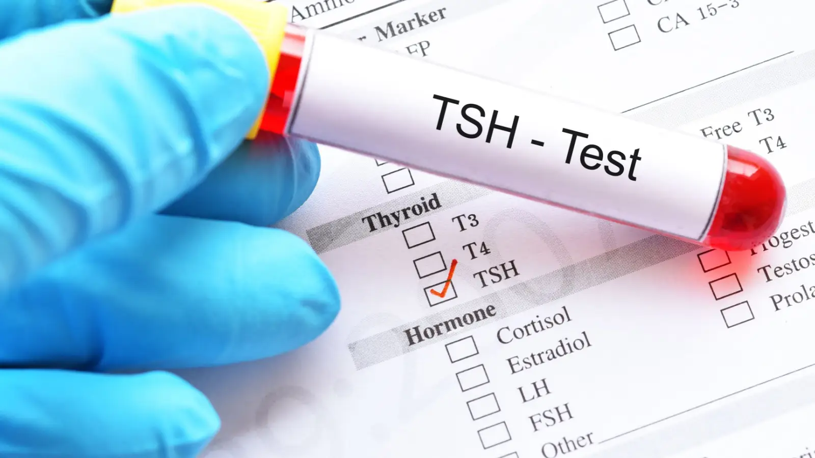 ماذا يخبرنا تحليل TSH؟