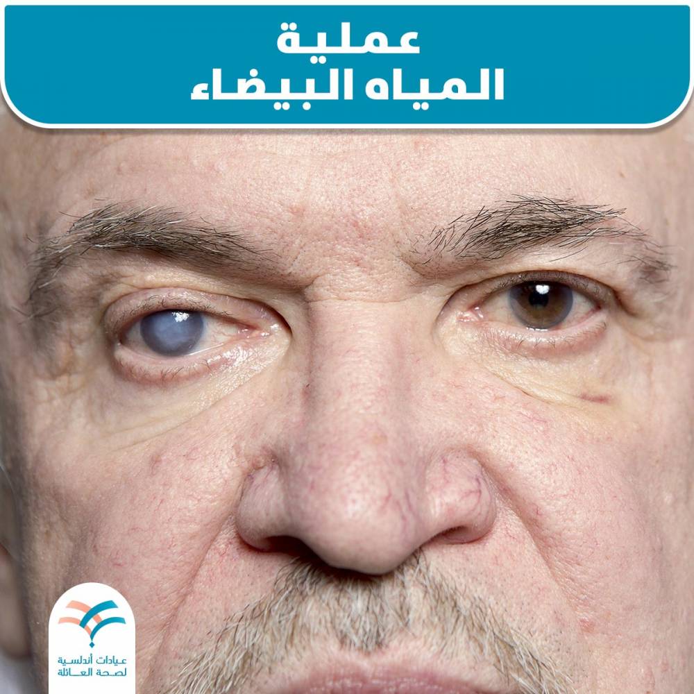 عملية المياه البيضاء
