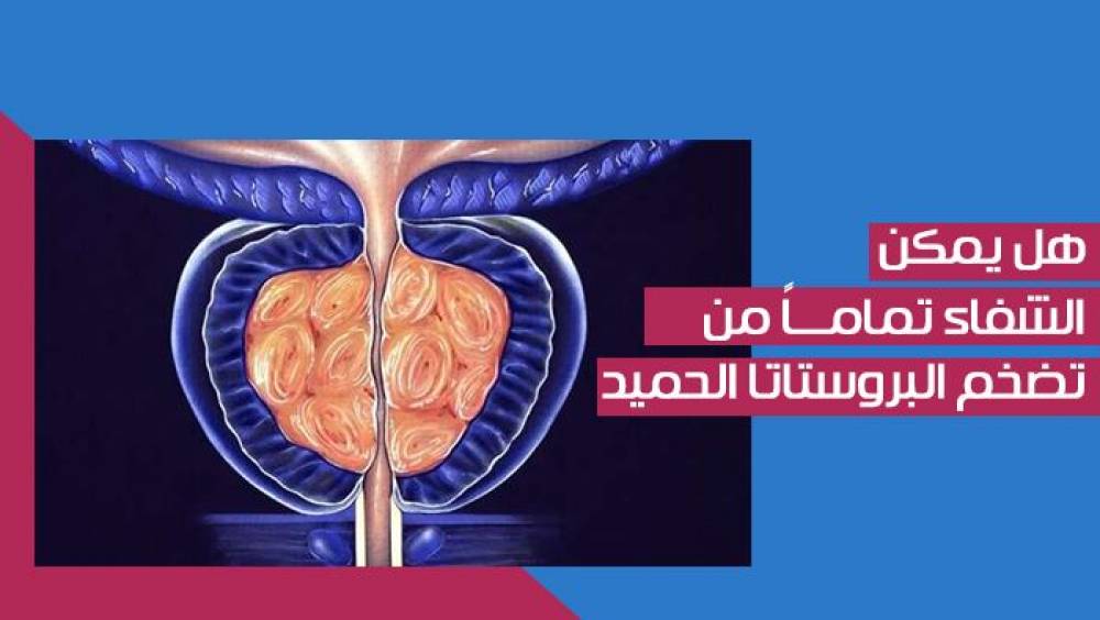 علاج تضخم البروستاتا