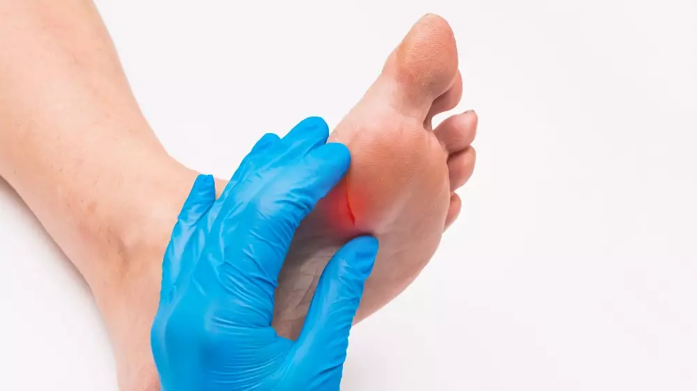 أعراض القدم السكرية وطرق الوقاية منها