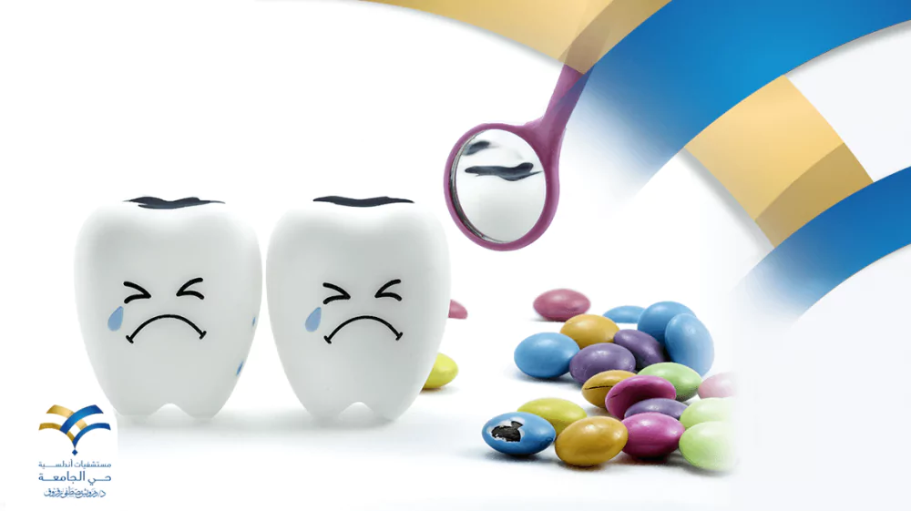 ما هي عدسات الأسنان وما هي أنواعها؟ ولماذا قد تحتاج إلى تركيبها؟