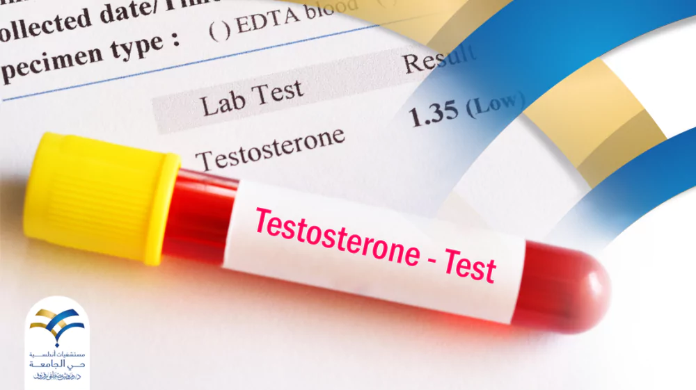 لماذا يطلب الطبيب تحليل التستوستيرون Total testosterone ومت هي أعراض انخفاضه؟