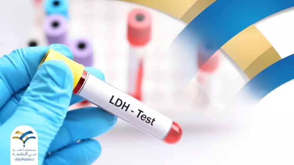 ما هو تحليل lactate Dehydrogenase؟ لماذا قد تحتاج إلى عمل تحليل LDH؟
