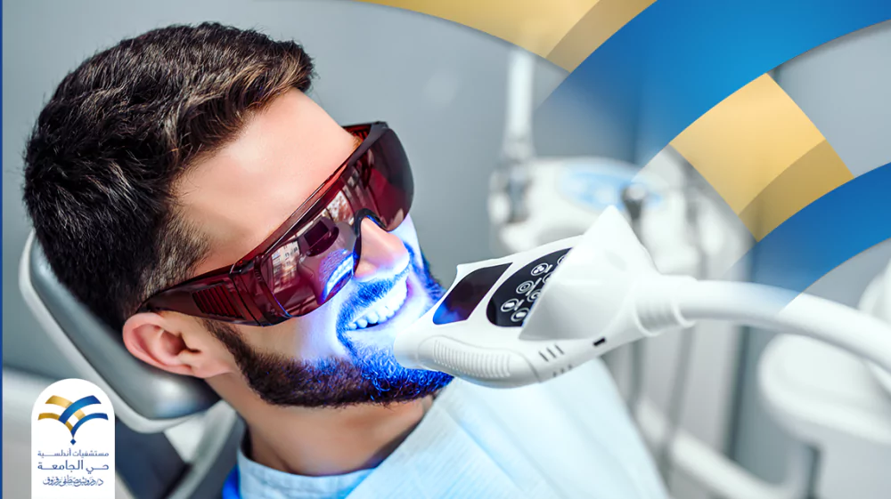 كم تستمر نتائج تبييض الأسنان بالليزر وكيف يتم إجراؤه؟