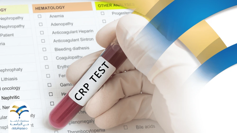ما هو تحليل CRP ولماذا يطلبه طبيبك؟