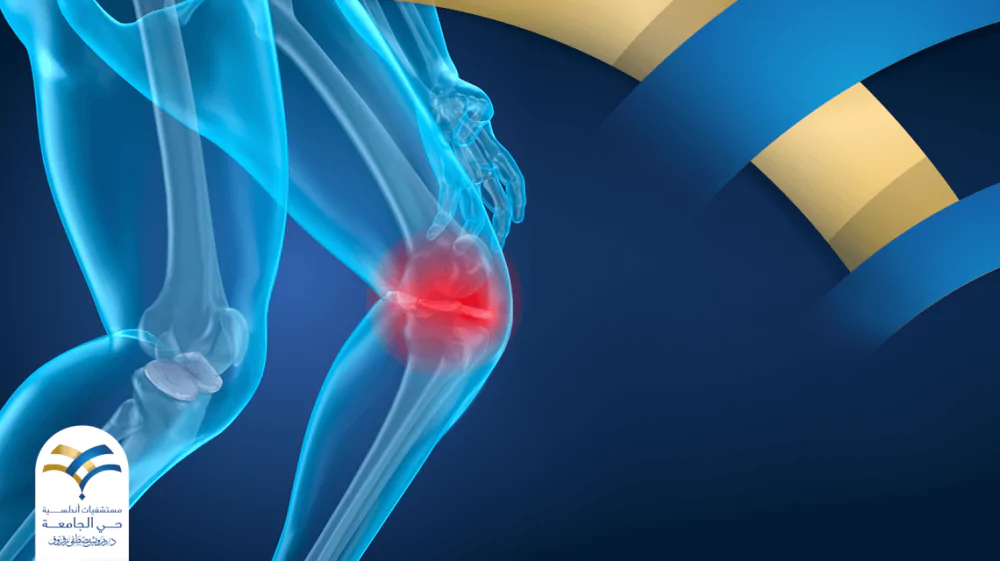 خشونة الركبة أسبابها وعلاجها وما هي طرق علاجها؟