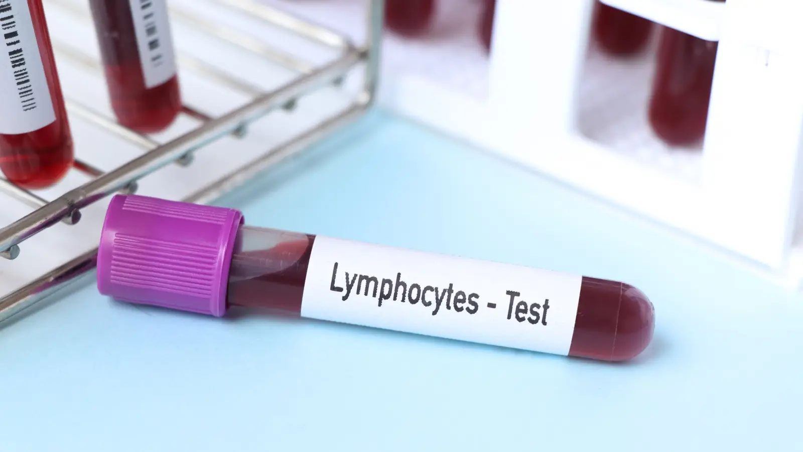 تحليل lymphocytes