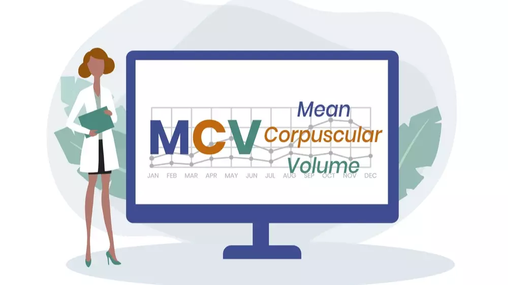 تحليل MCV