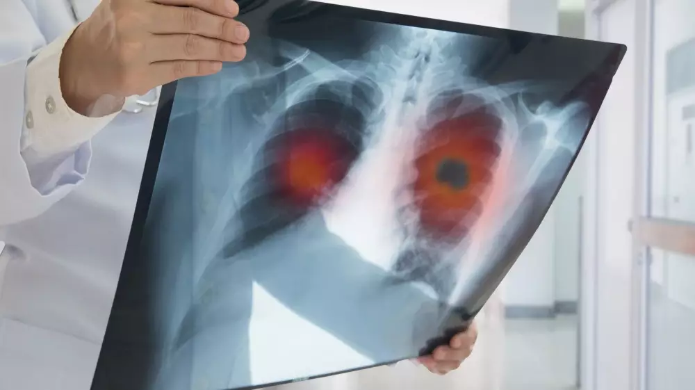 ما أشهر أمراض الجهاز التنفسي؟