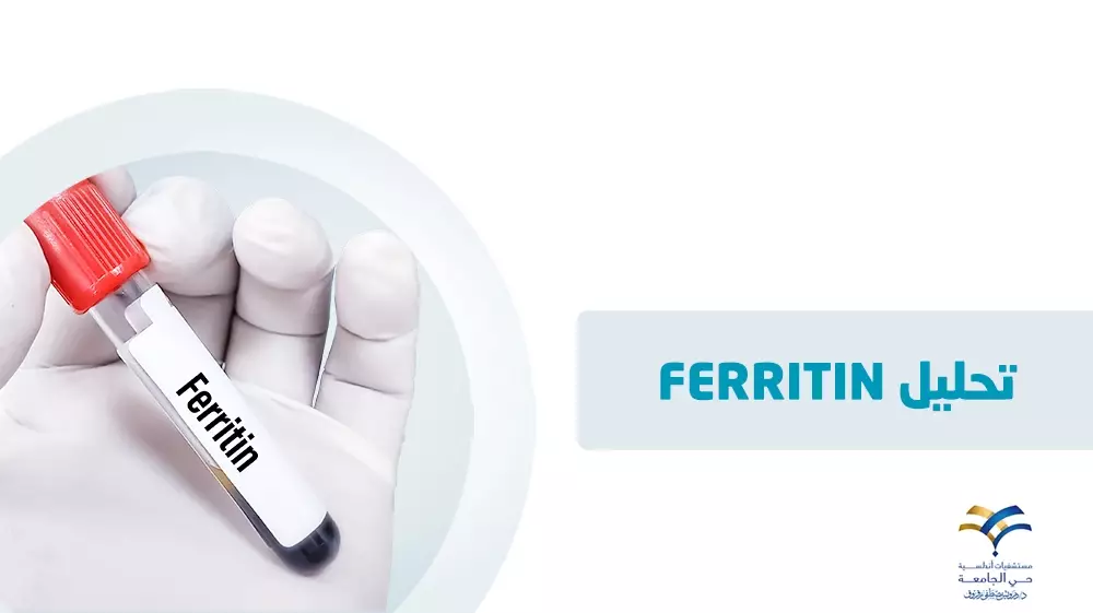 تحليل ferritin